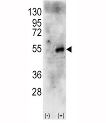 Western blot analysis of p70S6Kb antibody and 293 cell lysate (2 ug/lane) either nontransfected (Lan