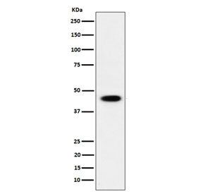 Western blot testing of human HEK293 cell lysate wit ADSS2 antibody. Predicted molecular weight ~50 KDa.