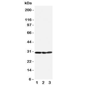 Western blot testing of human 1) HeLa, 2) A375 and 3) PANC cell lysate with COMT antibody. Predicted