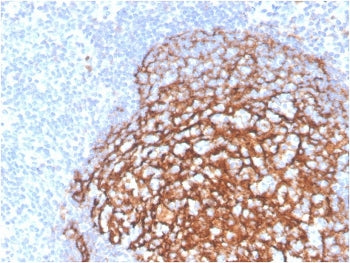 IHC staining of FFPE human tonsil tissue with recombinant CD21 antibody (clone CR2/3990R). HIER: boi