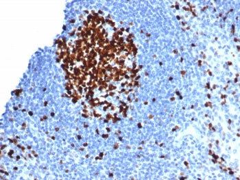 IHC staining of FFPE human tonsil tissue with Ki67 antibody (clone MKI67/6582). HIER: boil tissue se