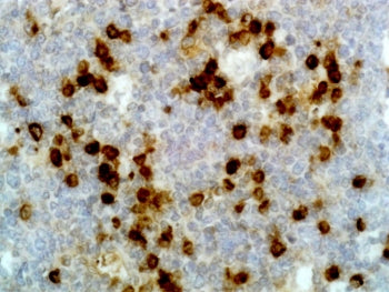 Lambda Light Chain Antibody / Lambda Antibody