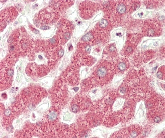 MT-ND5 Antibody / NADH-ubiquinone oxidoreductase chain 5