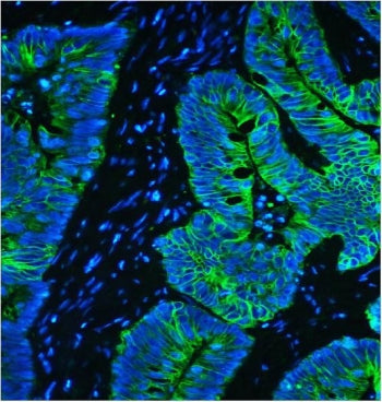 KRT8 Antibody / Cytokeratin 8