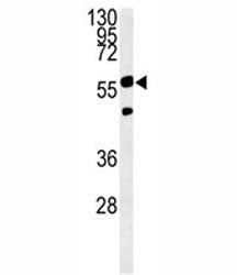 PHGDH Antibody