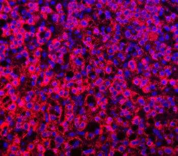 TTLL2 Antibody / Tubulin-tyrosine ligase-like protein 2