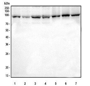 Western blot testing of 1) human Jurkat, 2) human 293T, 3) human K562, 4) human MCF7, 5) rat lung, 6