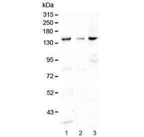 VEGF Receptor 1 / VEGFR1 Antibody