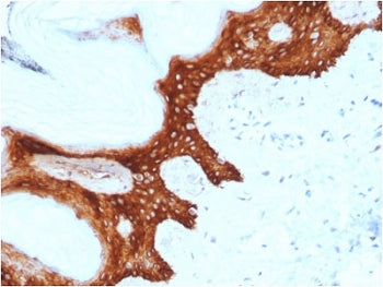14-3-3 sigma Antibody / SFN
