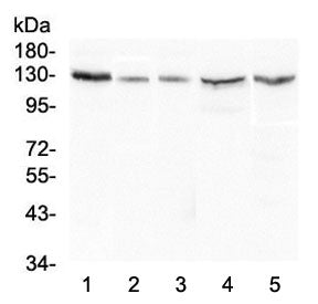 Calcium Sensing Receptor Antibody / CASR