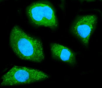 Immunofluorescent staining of FFPE human SiHa cells with GNB1 antibody (green) and DAPI nuclear stai