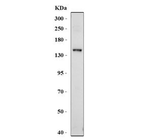 Western blot testing of ABCB4 antibody and human HepG2 cell lysate. Predicted molecular weight ~142 