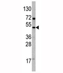 VEGFD Antibody