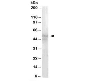 IRAK4 Antibody