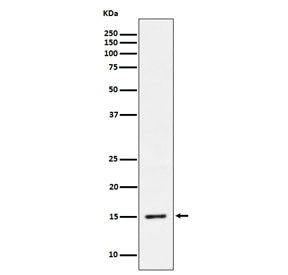 Western blot testing of lysate from HeLa cells treated with Calyculin A.