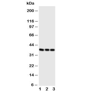 CD1a Antibody