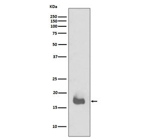 IL1 beta Antibody / IL1B
