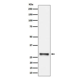 PNMT Antibody / Phenylethanolamine N-methyltransferase