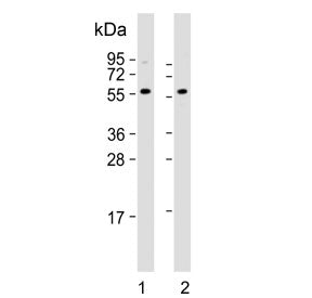 Presenilin 1 Antibody / PSEN1