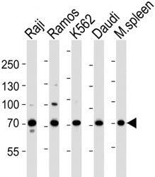 Western blot analysis of lysate from human Raji, Ramos, K562, Daudi cell line and mouse spleen tissu