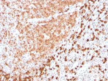 IHC testing of FFPE human tonsil with recombinant TCL1 antibody. HIER: boil tissue sections in pH 9 