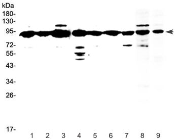 Western blot testing of human 1) HeLa, 2) placenta, 3) MCF7, 4) HepG2, 5) A549, 6) SKOV3, 7) PANC-1 