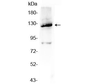 Western blot testing of human A549 cell lysate with Vinculin antibody at 0.5ug/ml. Predicted molecul