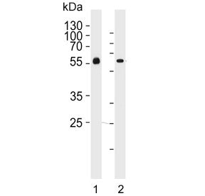 Western blot testing of human 1) blood plasma and 2) liver lysate with AHSG antibody. Predicted mole