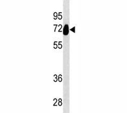 Alkaline phosphatase Antibody (placental)