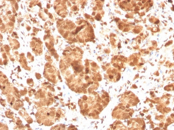 IHC staining of FFPE human tonsil with SOD1 antibody. HIER: boil tissue sections in pH 9 10mM Tris w