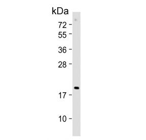Western blot testing of human Jurkat cell lysate with CDKN2D antibody. Predicted molecular weight ~1
