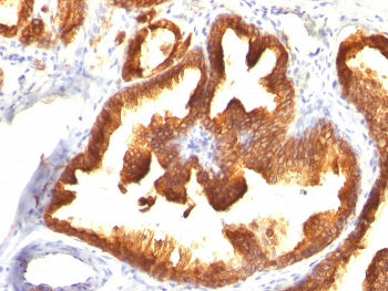 Cytokeratin 18 Antibody