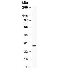 Western blot testing of rat eye lysate with AQP0 antibody. Observed molecular weight: 28-60 kDa depe