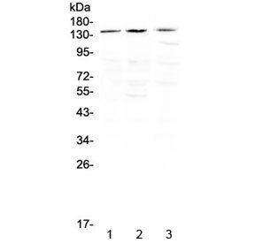 Western blot testing of human 1) HeLa, 2) SGC-7901 and 3) THP-1 cell lysate with TrkA antibdoy at 0.