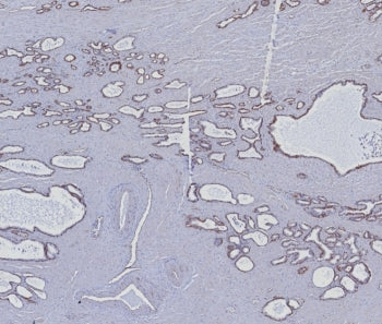 Cytokeratin 5/6 Antibody