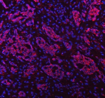 PAPSS2 Antibody