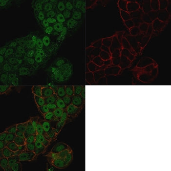 CHD4 Antibody / Chromodomain helicase DNA binding protein 4