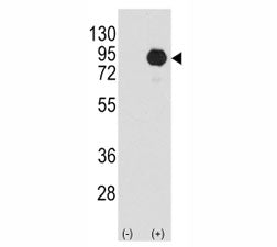 BRAF Antibody