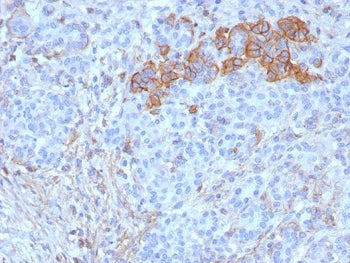 CD99 Antibody / MIC2