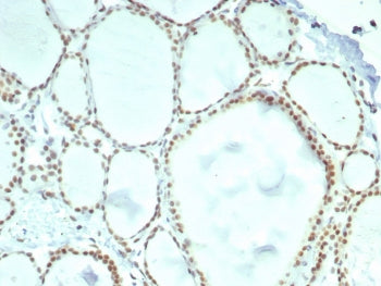 IHC staining of FFPE human thyroid tissue with ERCC1 antibody (clone ERCC1/7596). HIER: boil tissue 