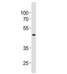 Western blot analysis of lysate from LNCaP cell line using Sox17 antibody diluted at 1:1000. Predict