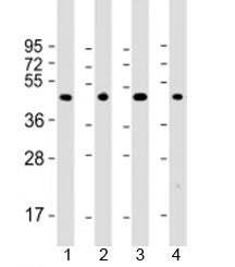 Thyroid hormone receptor alpha Antibody / THRA