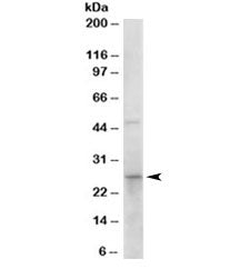 15-PGDH Antibody