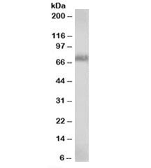 Western blot testing of A431cell lysate with RAD9A antibody at 0.3ug/ml. Predicted molecular weight: