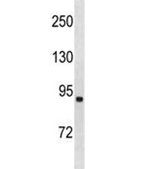 ACSL1 Antibody / FACL1