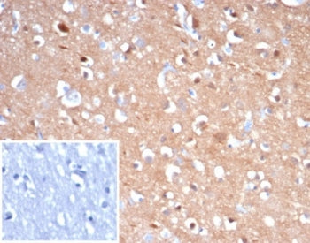 IHC staining of FFPE human brain tissue with recombinant TUBB3 antibody (clone rTUBB3/7405). Inset: 