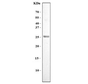 Fibroblast Growth Factor 11 Antibody / FGF11