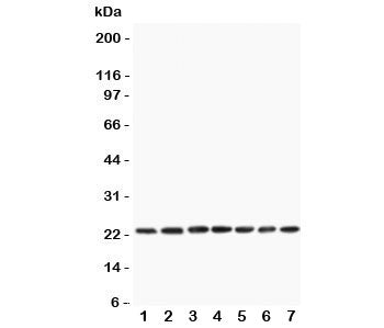Western blot testing of CNTF antibody and rat samples 1: PC12; 2: NRK; 3: RH35; 4: brain; 5: liver; 