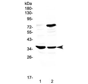 CD23 Antibody