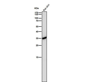 Rat liver tissue lysate tested with the CASP6 antibody at 1:1000 dilution for 1 hour at room temperature. Expected molecular weight: 34-36 kDa.